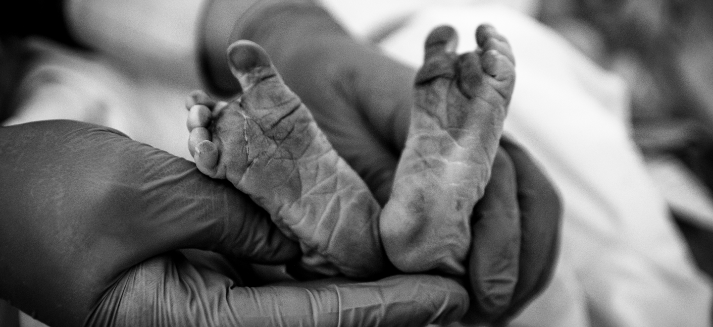 Imagem de pés de recém nascido